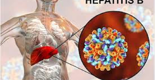 Hepatitis: Misconceptions, Management And Prevention