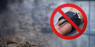 Doctor warns against tourniquet use in snakebite cases