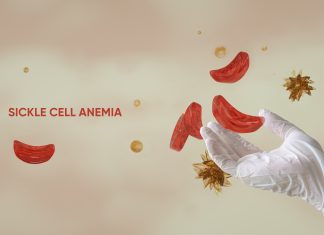 Sickle cell advocates call for expanded health insurance coverage