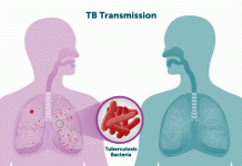 World Health Assembly approves new global tuberculosis strategy beyond 2030