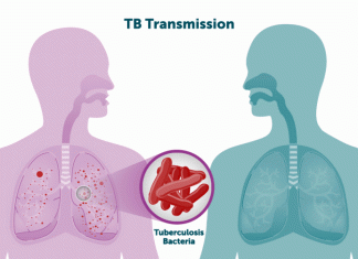 World Health Assembly approves new global tuberculosis strategy beyond 2030